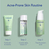 Acne Prone Skin Essentials