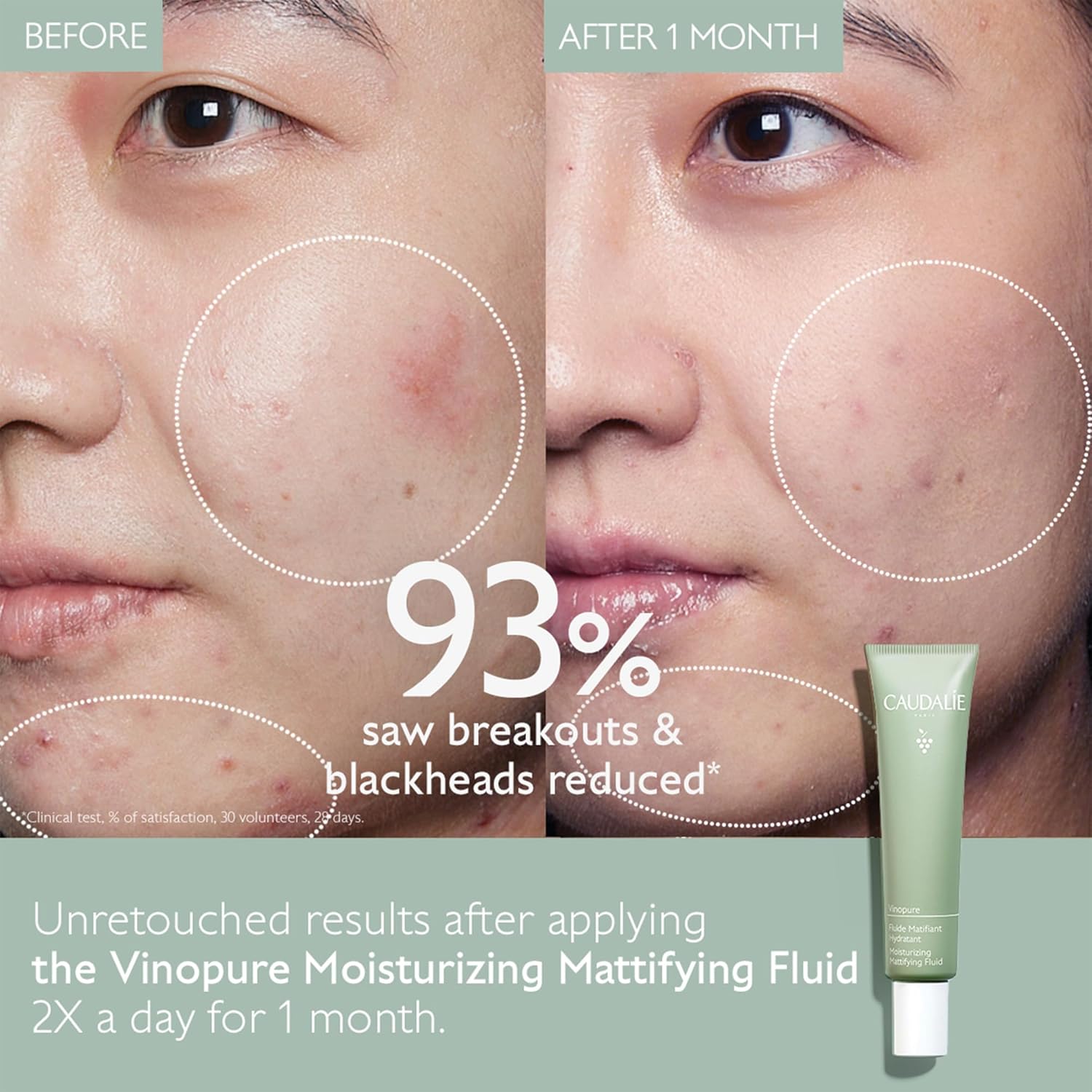 Vinopure Moisturizing Mattifying Fluid