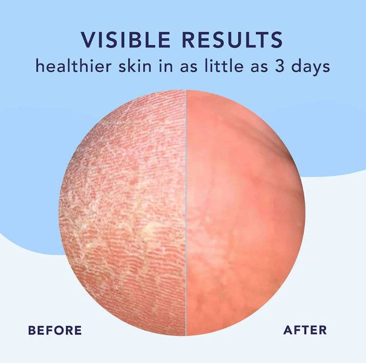 High Dive Intensive Hydration Cream | Soften & Smooth