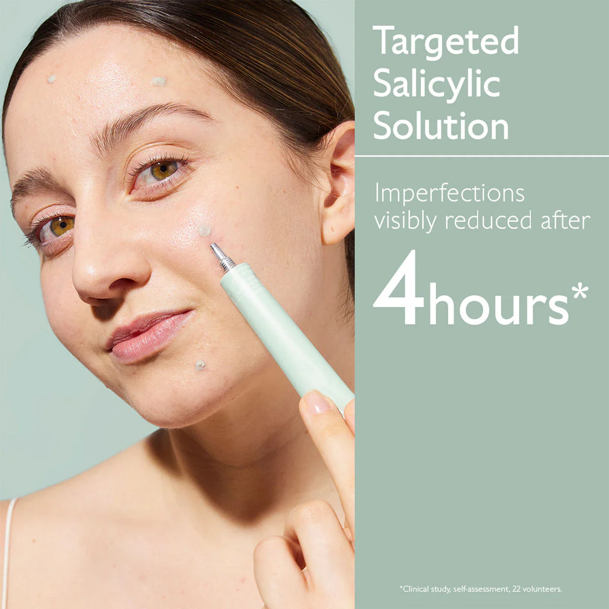 Vinopure Color Correcting Spot Solution with Salicylic Acid